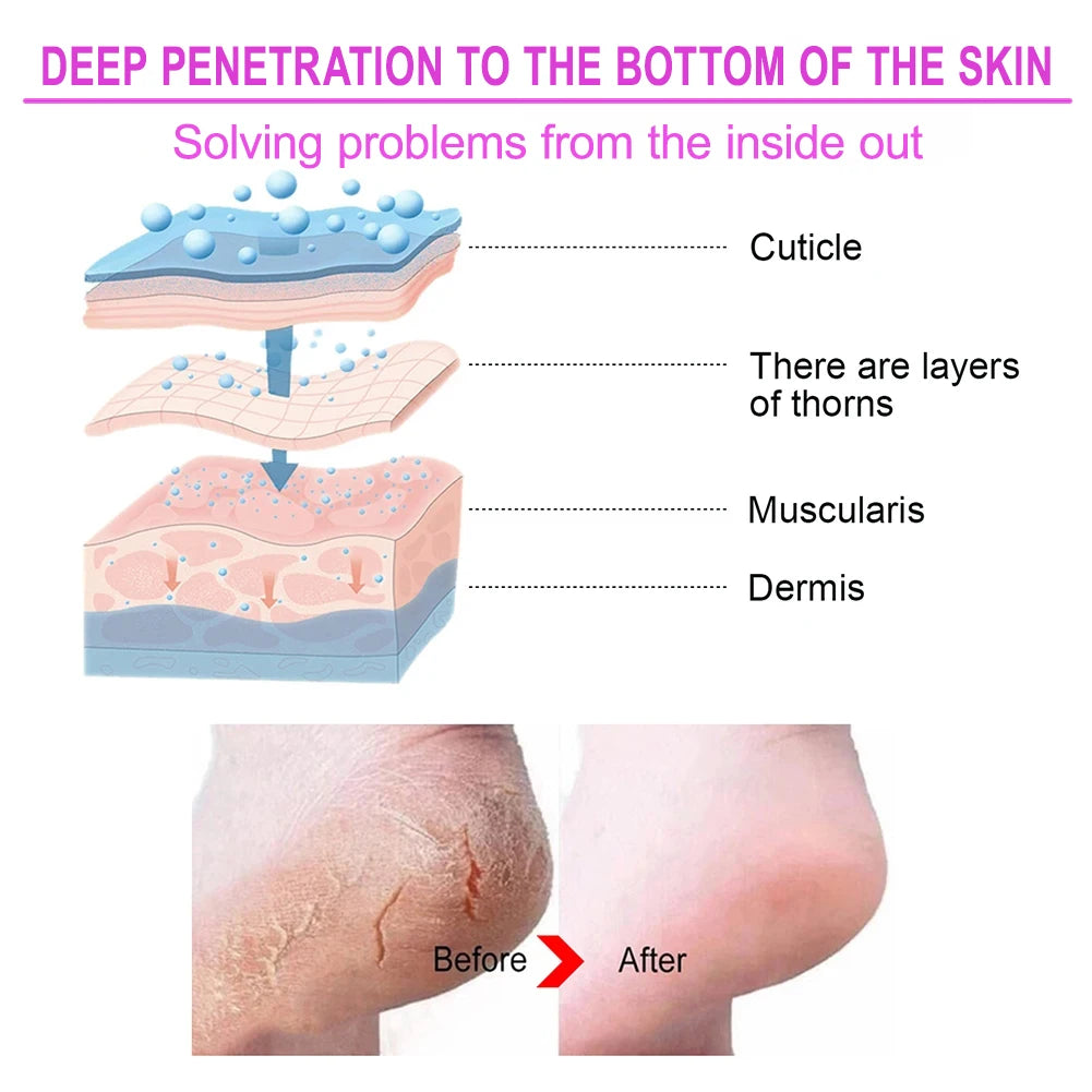 2Pcs Exfoliating Foot Mask