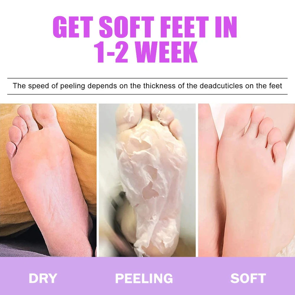 2Pcs Exfoliating Foot Mask 