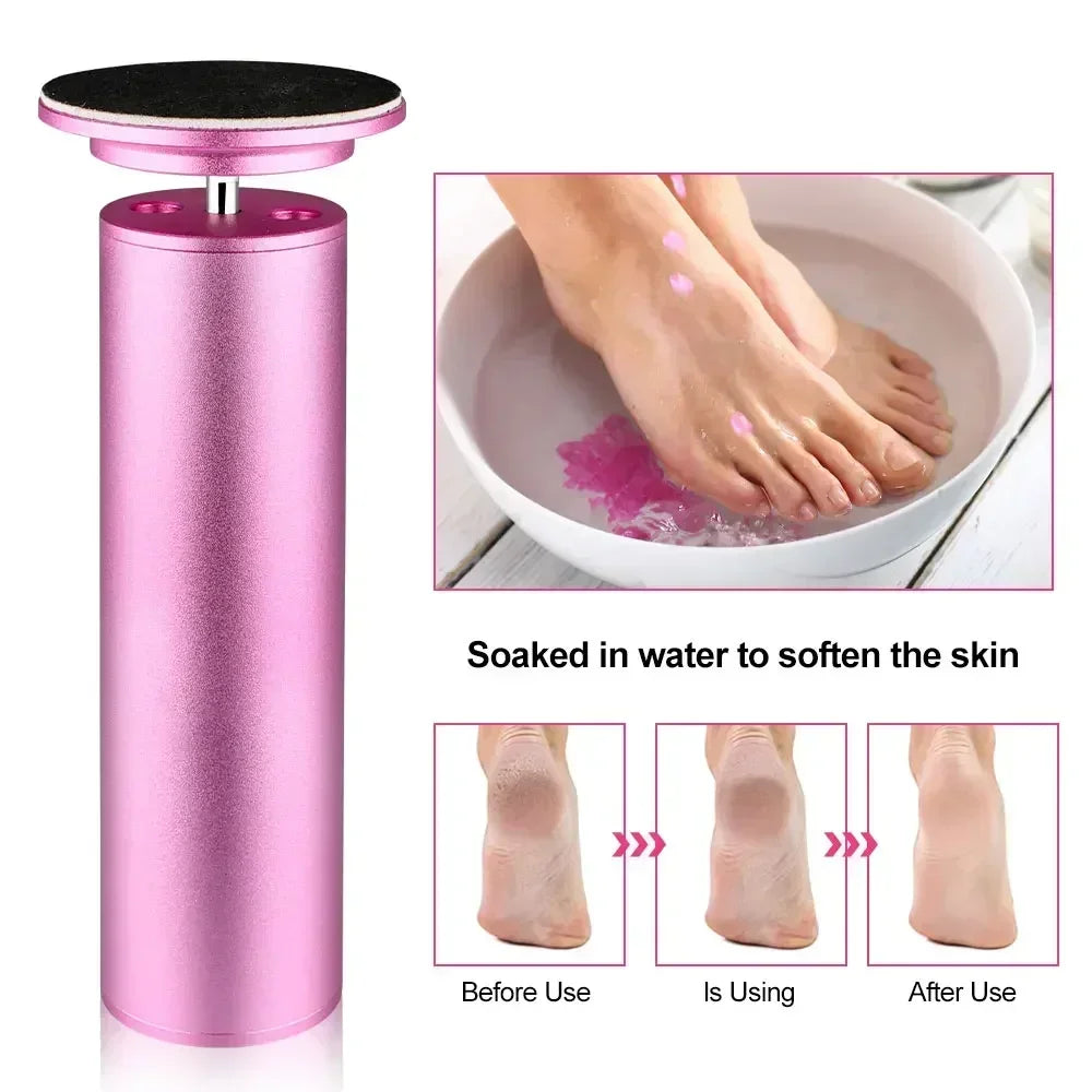 Stone™️ Electric Foot Callus Remover
