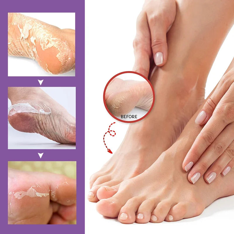 2Pcs Exfoliating Foot Mask 