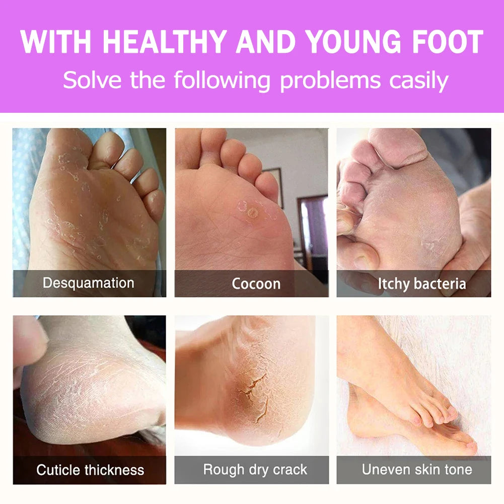 2Pcs Exfoliating Foot Mask 