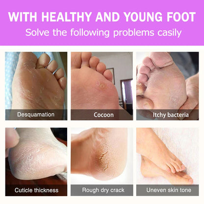 2Pcs Exfoliating Foot Mask 